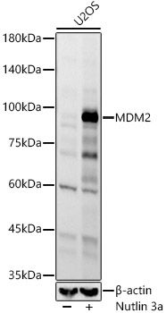 MDM2 Rabbit mAb