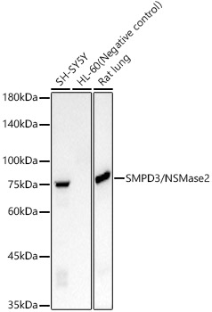 SMPD3/NSMase2 Rabbit mAb