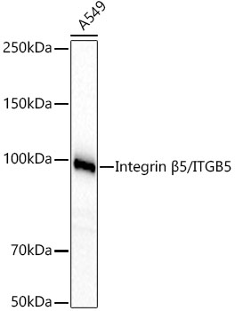 Integrin β5/ITGB5 Rabbit mAb