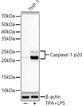 Caspase-1 Rabbit mAb