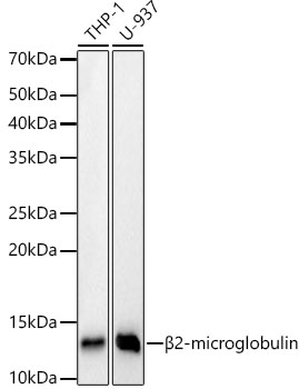 [KD Validated] beta 2 Microglobulin Rabbit mAb