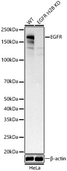 [KD Validated] EGFR Rabbit mAb