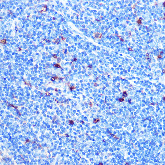 FGF21 Rabbit mAb