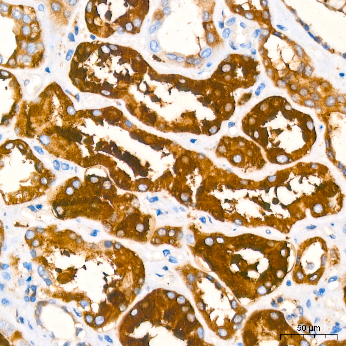 FGF21 Rabbit mAb