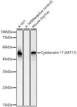 Cytokeratin 17 (KRT17) Rabbit mAb