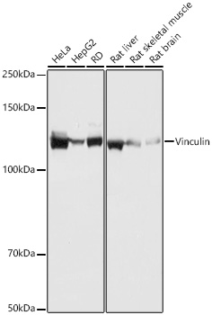 Vinculin Rabbit mAb