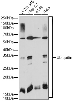 Ubiquitin Rabbit mAb