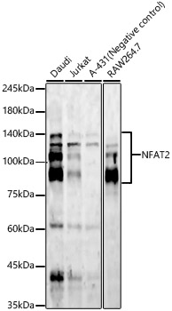 NFAT2 Rabbit mAb