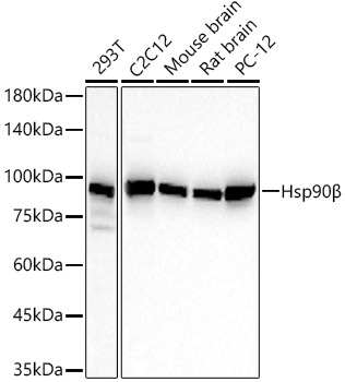 Hsp90β Rabbit mAb