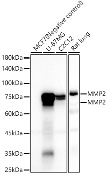 MMP2 Rabbit mAb