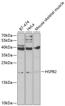 HSPB2 Rabbit pAb