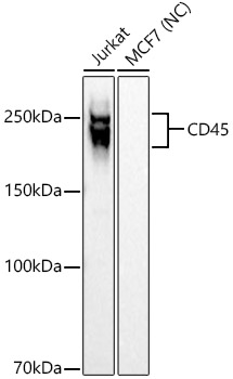 CD45 Rabbit mAb