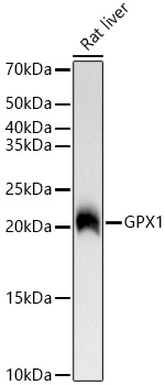 GPX1 Rabbit mAb