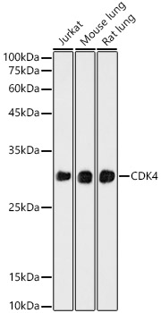 CDK4 Rabbit mAb