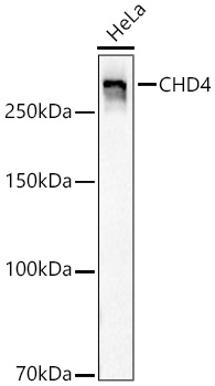 CHD4 Rabbit mAb