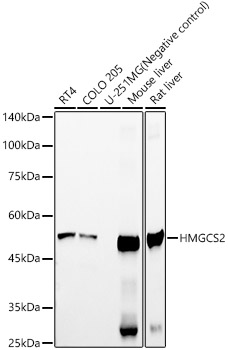 HMGCS2 Rabbit mAb