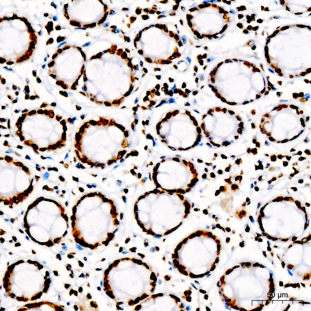 DiMethyl-Histone H3-K27 Rabbit pAb