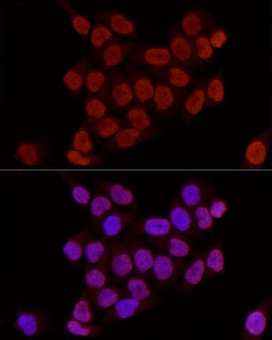 DiMethyl-Histone H3-K27 Rabbit pAb