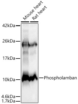 Phospholamban Rabbit mAb