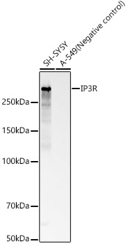 IP3R Rabbit mAb