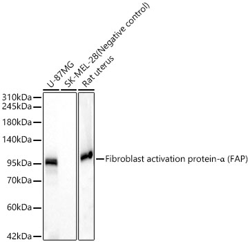 Fibroblast activation protein-α (FAP) Rabbit mAb