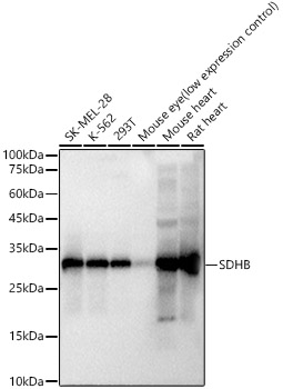 SDHB Rabbit mAb