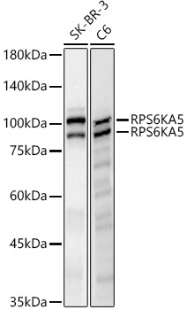 RPS6KA5 Rabbit mAb