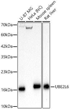 UBE2L6 Rabbit mAb