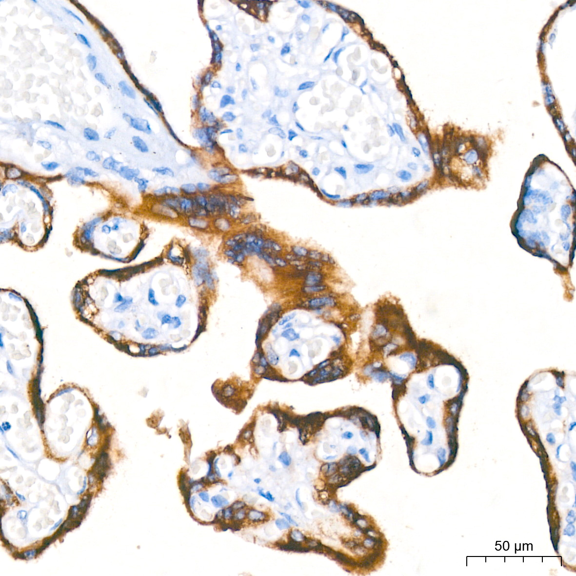 その他 lhb LH(CGA/LHB) Rabbit mAb