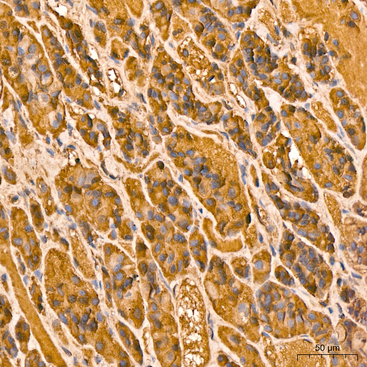 LH(CGA/LHB) Rabbit mAb