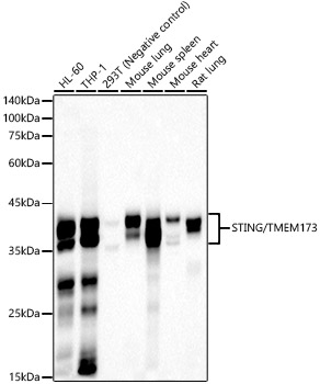 STING/TMEM173 Rabbit mAb