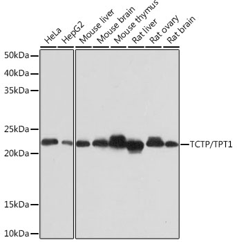 TCTP/TPT1 Rabbit mAb