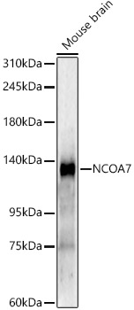 NCOA7 Rabbit mAb