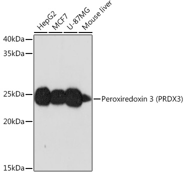 Peroxiredoxin 3 (PRDX3) Rabbit mAb