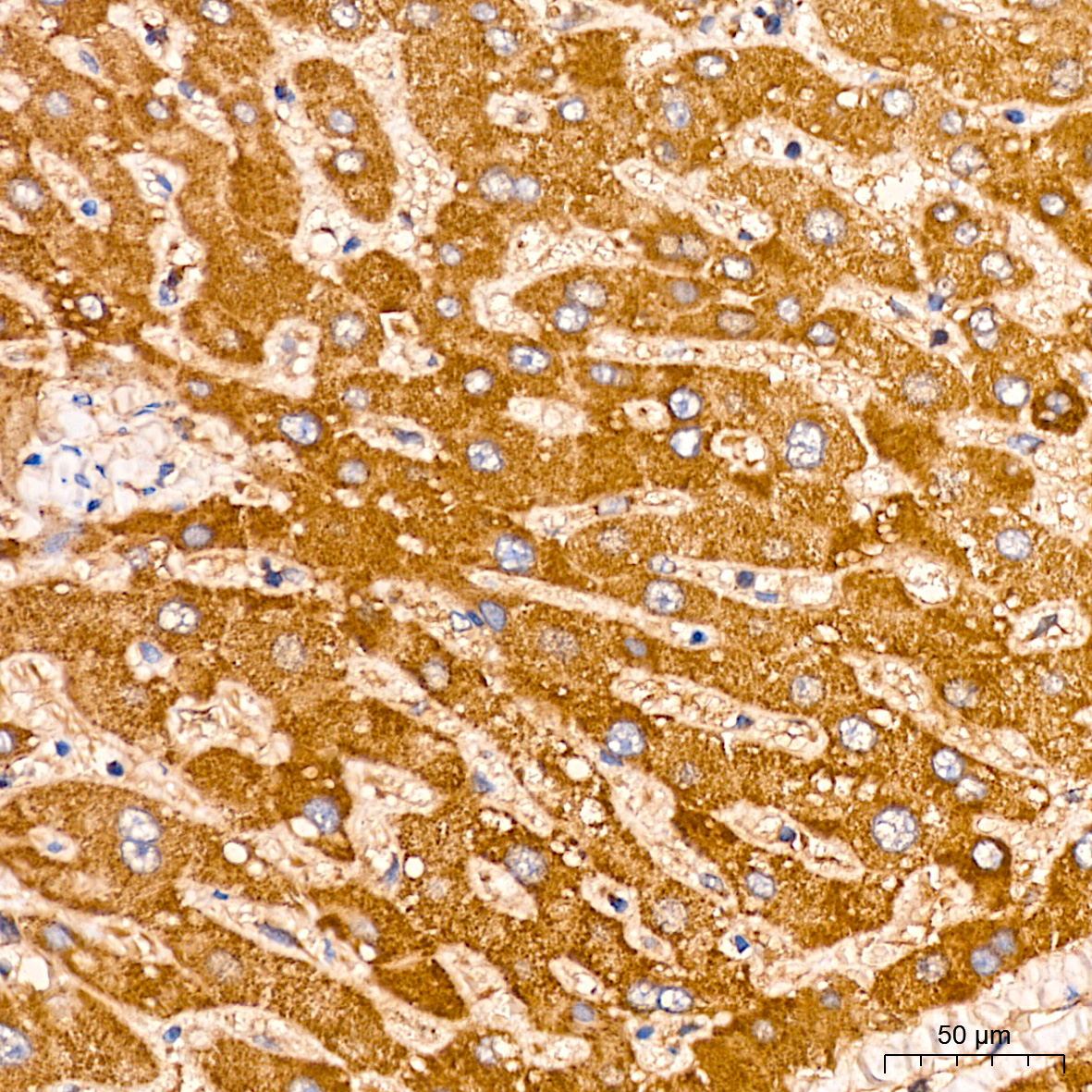 Peroxiredoxin 3 (PRDX3) Rabbit mAb
