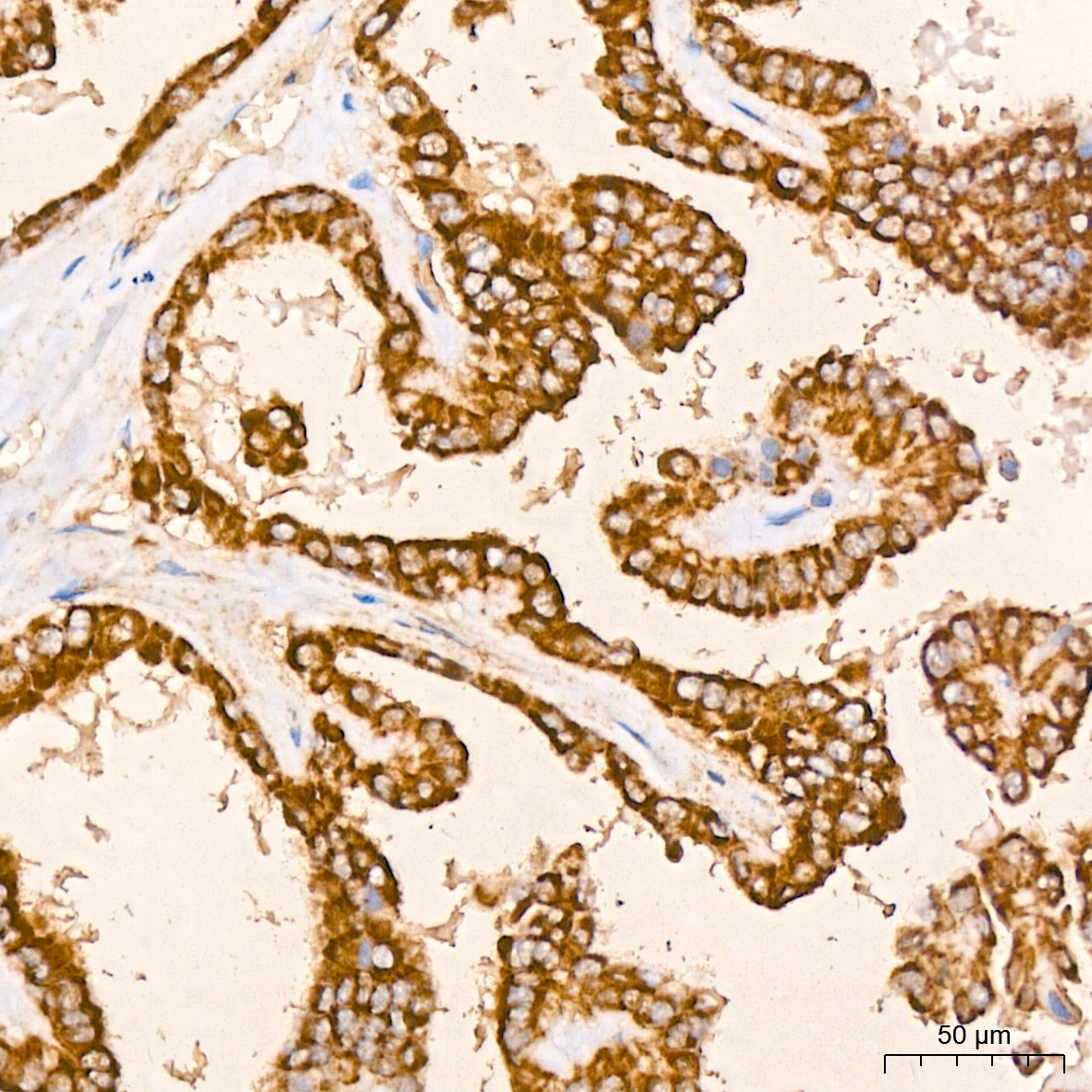 P.pedro 胞子③ Peroxiredoxin 3 (PRDX3) Rabbit mAb