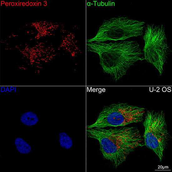 Peroxiredoxin 3 (PRDX3) Rabbit mAb