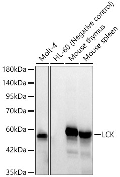 LCK Rabbit mAb