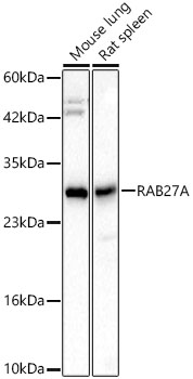 RAB27A Rabbit mAb