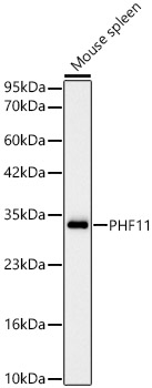 [KD Validated] PHF11 Rabbit mAb