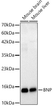 BNP Rabbit mAb