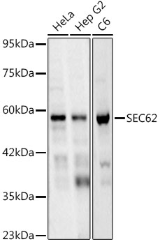 SEC62 Rabbit mAb