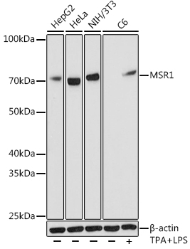 MSR1 Rabbit mAb