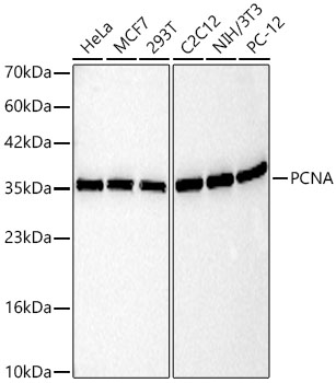 PCNA Mouse mAb