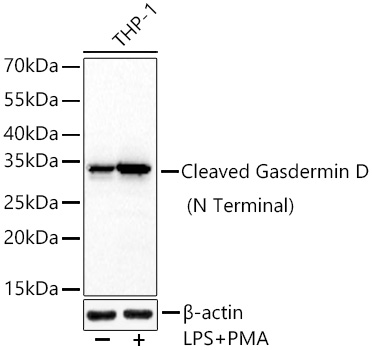 [KO Validated] Cleaved Gasdermin D (N Terminal) Rabbit mAb