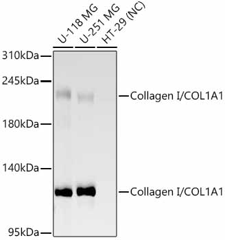 Collagen I/COL1A1 Rabbit mAb