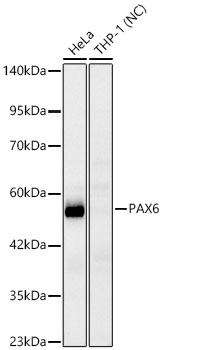 PAX6 Rabbit mAb