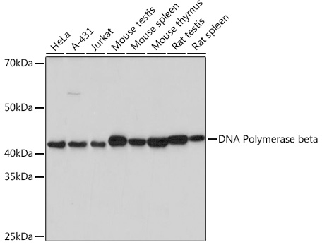 DNA Polymerase beta Rabbit mAb