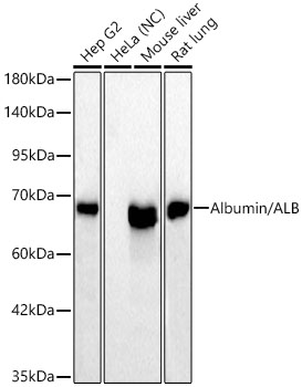 Albumin/ALB Rabbit mAb