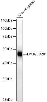 EPCR/CD201 Rabbit mAb